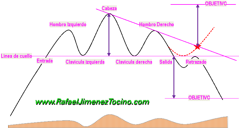 Figura Hombro-Cabeza-Hombro