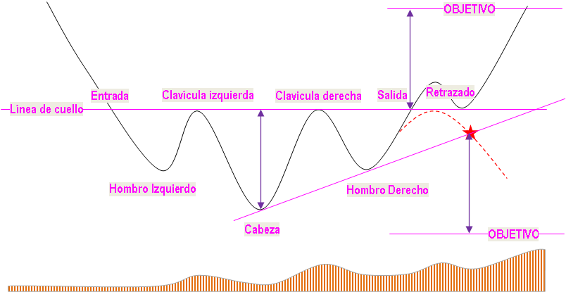 Figura Hombro-Cabeza-Hombro (invertido)